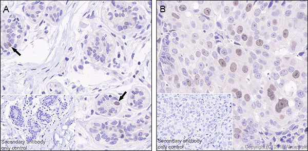 Immunohistochemistry (Formalin/PFA-fixed paraffin-embedded sections) - Anti-CDC7 antibody [EPR20337] (AB229187)