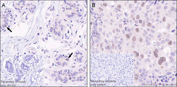 Immunohistochemistry (Formalin/PFA-fixed paraffin-embedded sections) - Anti-CDC7 antibody [EPR20337] - BSA and Azide free (AB251585)