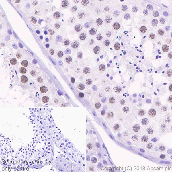 Immunohistochemistry (Formalin/PFA-fixed paraffin-embedded sections) - Anti-CDC7 antibody [EPR20337] - BSA and Azide free (AB251585)
