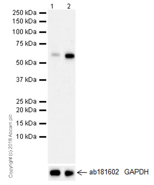Western blot - Anti-CDC7 antibody [EPR20337] - BSA and Azide free (AB251585)