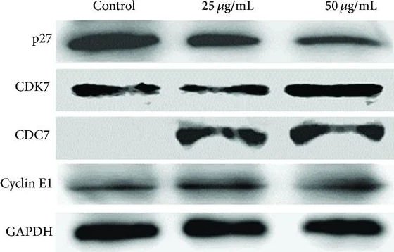 Western blot - Anti-CDC7 antibody [EPR4730] (AB108332)