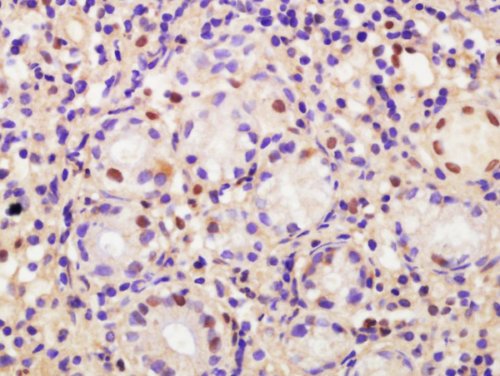 Immunohistochemistry (Formalin/PFA-fixed paraffin-embedded sections) - Anti-CDCA2 antibody (AB214289), expandable thumbnail