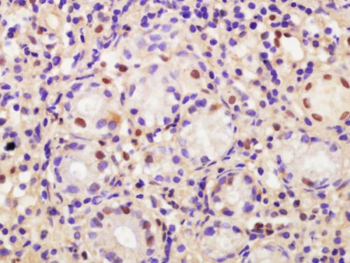 Immunohistochemistry (Formalin/PFA-fixed paraffin-embedded sections) - Anti-CDCA2 antibody (AB214289)