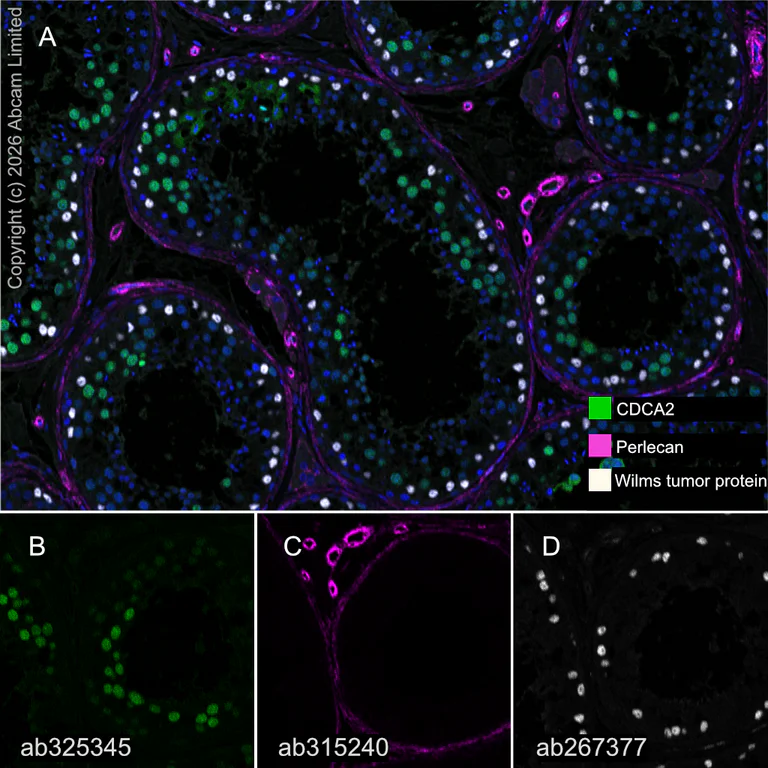 Multiplex immunohistochemistry - Anti-CDCA2 antibody [EPR28722-6] (AB325345)