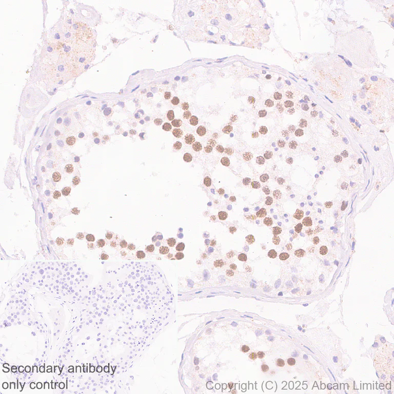 Immunohistochemistry (Formalin/PFA-fixed paraffin-embedded sections) - Anti-CDCA2 antibody [EPR28722-6] - BSA and Azide free (AB325353)