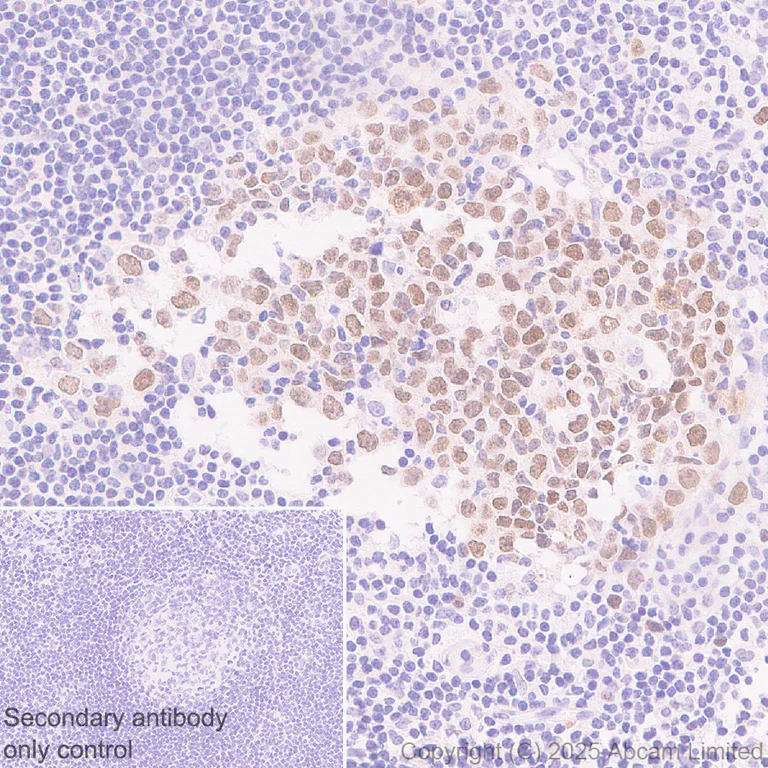 Immunohistochemistry (Formalin/PFA-fixed paraffin-embedded sections) - Anti-CDCA2 antibody [EPR28722-6] - BSA and Azide free (AB325353)