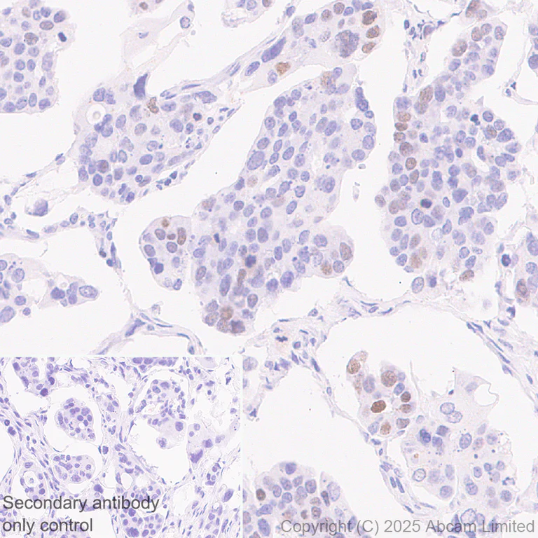 Immunohistochemistry (Formalin/PFA-fixed paraffin-embedded sections) - Anti-CDCA2 antibody [EPR28722-6] - BSA and Azide free (AB325353)