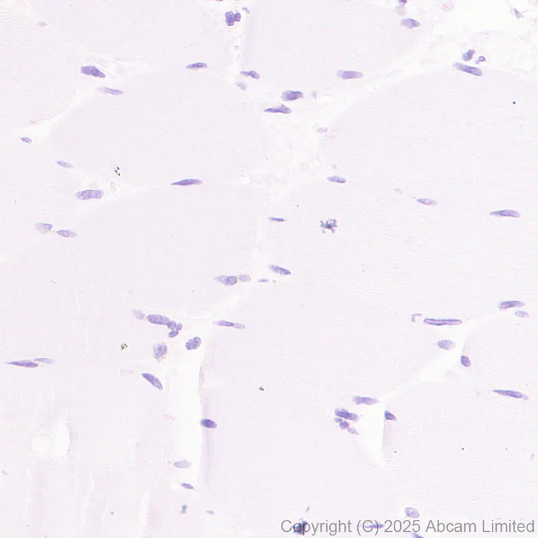Immunohistochemistry (Formalin/PFA-fixed paraffin-embedded sections) - Anti-CDCA2 antibody [EPR28722-6] - BSA and Azide free (AB325353)