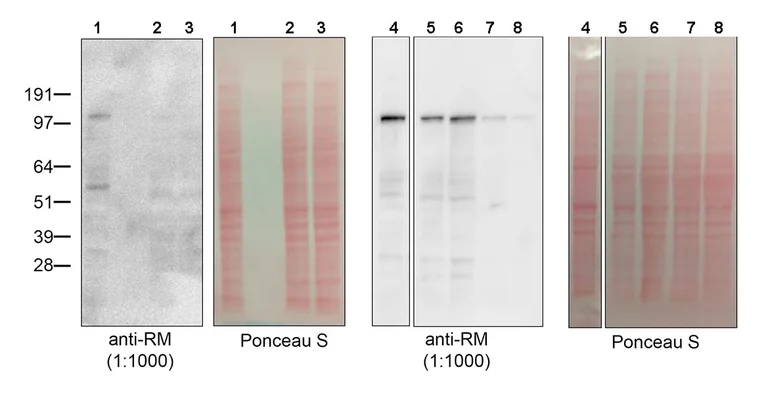 Western blot - Anti-CDCA2 antibody [EPR28722-6] - BSA and Azide free (AB325353)
