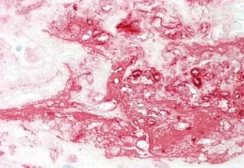 Immunohistochemistry (Formalin/PFA-fixed paraffin-embedded sections) - Anti-CDCA3 antibody - C-terminal (AB167037)