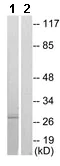 Western blot - Anti-CDCA3 antibody - C-terminal (AB167037)