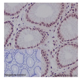 Immunohistochemistry (Formalin/PFA-fixed paraffin-embedded sections) - Anti-CDCA5 antibody [EPR16331] - BSA and Azide free (AB240328), expandable thumbnail