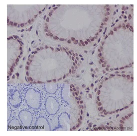 Immunohistochemistry (Formalin/PFA-fixed paraffin-embedded sections) - Anti-CDCA5 antibody [EPR16331] - BSA and Azide free (AB240328)