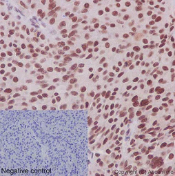 Immunohistochemistry (Formalin/PFA-fixed paraffin-embedded sections) - Anti-CDCA5 antibody [EPR16331] - BSA and Azide free (AB240328)