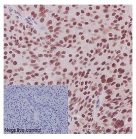 Immunohistochemistry (Formalin/PFA-fixed paraffin-embedded sections) - Anti-CDCA5 antibody [EPR16331] - C-terminal (AB192237)
