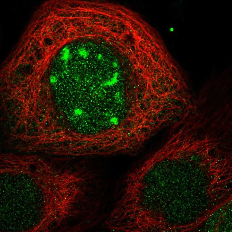 Immunocytochemistry/ Immunofluorescence - Anti-CDCA7L/HR1 antibody (AB246958)