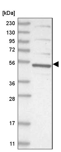 Western blot - Anti-CDCA7L/HR1 antibody (AB246958)