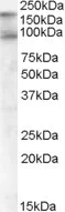 Western blot - Anti-CDCP1 antibody (AB1377)