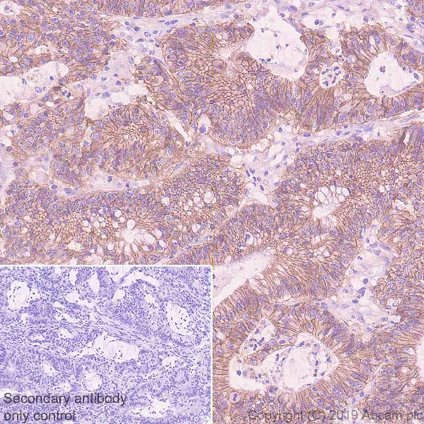 Immunohistochemistry (Formalin/PFA-fixed paraffin-embedded sections) - Anti-CDCP1 antibody [EPR23162-102] (AB252947)