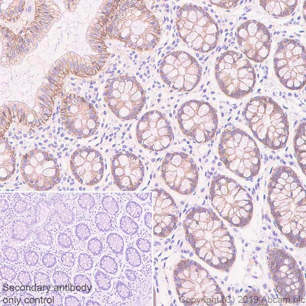 Immunohistochemistry (Formalin/PFA-fixed paraffin-embedded sections) - Anti-CDCP1 antibody [EPR23162-102] - BSA and Azide free (AB264472)