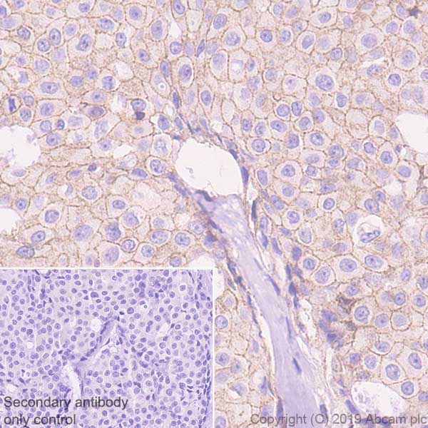 Immunohistochemistry (Formalin/PFA-fixed paraffin-embedded sections) - Anti-CDCP1 antibody [EPR23162-102] - BSA and Azide free (AB264472)