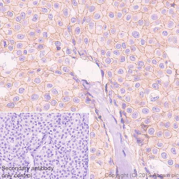 Immunohistochemistry (Formalin/PFA-fixed paraffin-embedded sections) - Anti-CDCP1 antibody [EPR23162-102] - BSA and Azide free (AB264472)