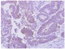 Immunohistochemistry (Formalin/PFA-fixed paraffin-embedded sections) - Anti-CDGSH iron sulfur domain-containing protein 2 homolog antibody (AB127740), expandable thumbnail