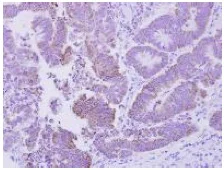 Immunohistochemistry (Formalin/PFA-fixed paraffin-embedded sections) - Anti-CDGSH iron sulfur domain-containing protein 2 homolog antibody (AB127740)