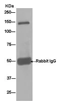 Immunoprecipitation - Anti-CDH12 antibody [EPR14164] (AB181860)