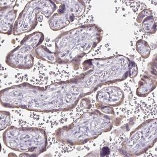 Immunohistochemistry (Formalin/PFA-fixed paraffin-embedded sections) - Anti-CDH19 antibody (AB185573)