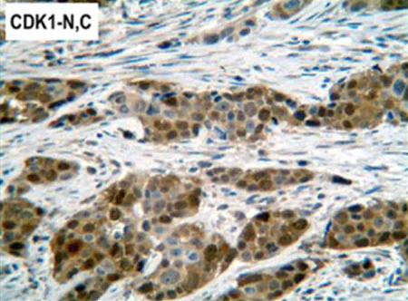 Immunohistochemistry (Formalin/PFA-fixed paraffin-embedded sections) - Anti-CDK1 antibody [A17] (AB18)