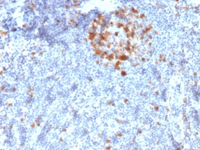 Immunohistochemistry (Formalin/PFA-fixed paraffin-embedded sections) - Anti-CDK1 antibody [A17.1.1] - BSA and Azide free (AB236309)