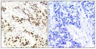 Immunohistochemistry (Formalin/PFA-fixed paraffin-embedded sections) - Anti-CDK1 antibody (AB131450)