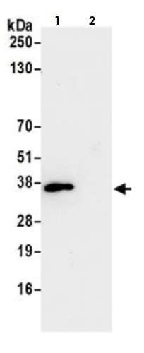 Immunoprecipitation - Anti-CDK1 antibody [BLR085G] (AB265590)