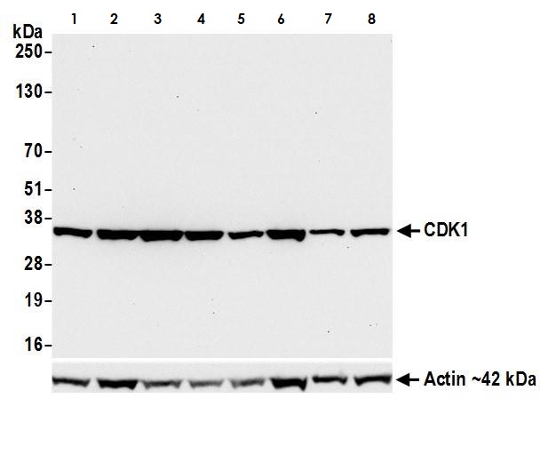 Western blot - Anti-CDK1 antibody [BLR085G] (AB265590), expandable thumbnail