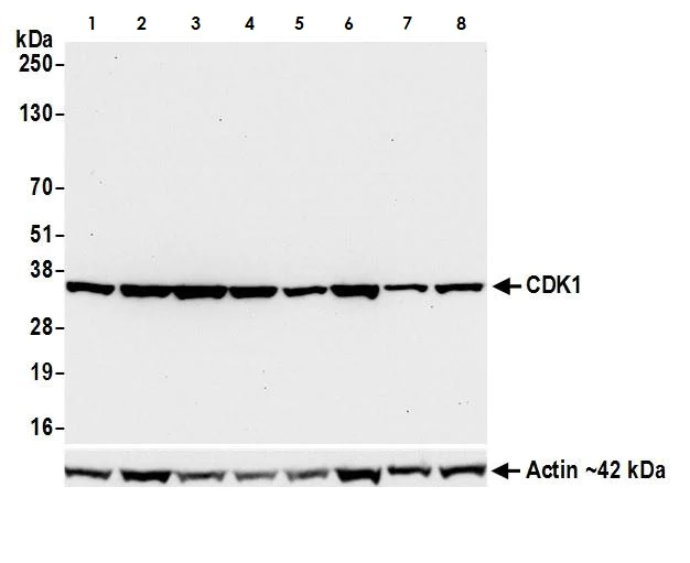 Western blot - Anti-CDK1 antibody [BLR085G] (AB265590)