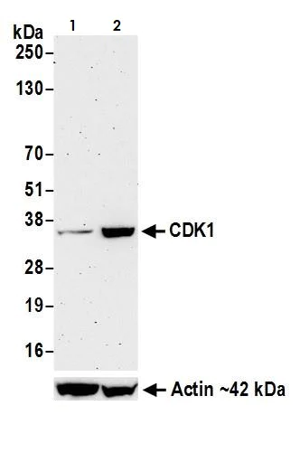 Western blot - Anti-CDK1 antibody [BLR085G] (AB265590)