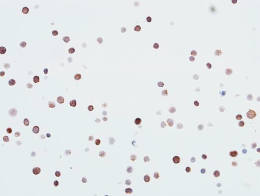 Immunocytochemistry - Anti-CDK1 antibody [BLR085G] - BSA free (AB272070), expandable thumbnail