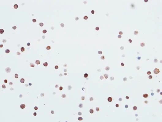 Immunocytochemistry - Anti-CDK1 antibody [BLR085G] - BSA free (AB272070)