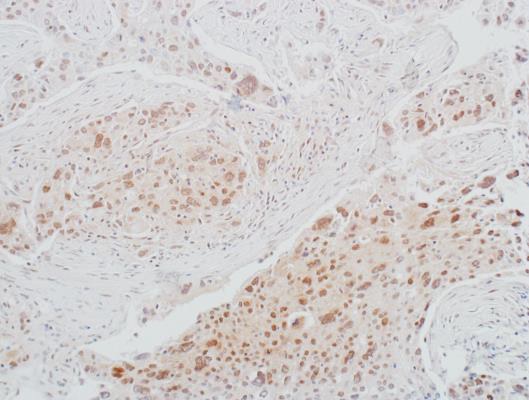 Immunohistochemistry (Formalin/PFA-fixed paraffin-embedded sections) - Anti-CDK1 antibody [BLR085G] - BSA free (AB272070), expandable thumbnail