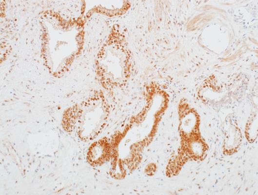 Immunohistochemistry (Formalin/PFA-fixed paraffin-embedded sections) - Anti-CDK1 antibody [BLR085G] - BSA free (AB272070), expandable thumbnail