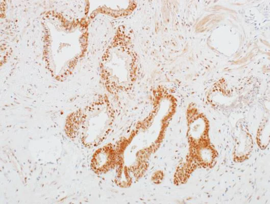 Immunohistochemistry (Formalin/PFA-fixed paraffin-embedded sections) - Anti-CDK1 antibody [BLR085G] - BSA free (AB272070)
