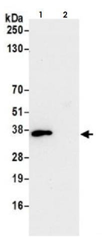 Immunoprecipitation - Anti-CDK1 antibody [BLR085G] - BSA free (AB272070), expandable thumbnail