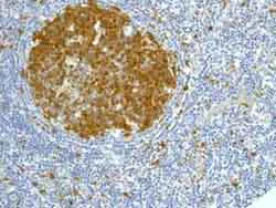 Immunohistochemistry (Formalin/PFA-fixed paraffin-embedded sections) - Anti-CDK1 antibody [EPR165] (AB133327)