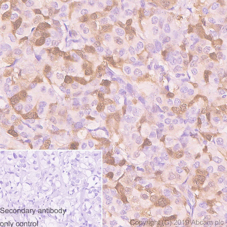 Immunohistochemistry (Formalin/PFA-fixed paraffin-embedded sections) - Anti-CDK1 antibody [YE324] (AB32094)
