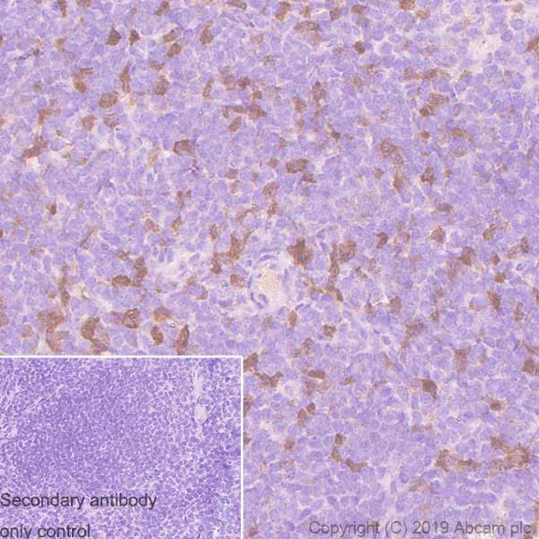 Immunohistochemistry (Formalin/PFA-fixed paraffin-embedded sections) - Anti-CDK1 antibody [YE324] - BSA and Azide free (AB247227)