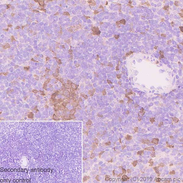 Immunohistochemistry (Formalin/PFA-fixed paraffin-embedded sections) - Anti-CDK1 antibody [YE324] - BSA and Azide free (AB247227), expandable thumbnail