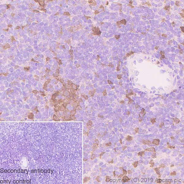 Immunohistochemistry (Formalin/PFA-fixed paraffin-embedded sections) - Anti-CDK1 antibody [YE324] - BSA and Azide free (AB247227)