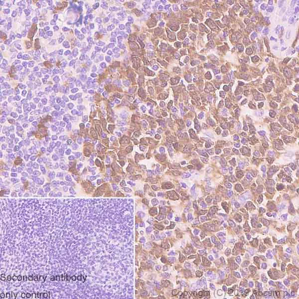 Immunohistochemistry (Formalin/PFA-fixed paraffin-embedded sections) - Anti-CDK1 antibody [YE324] - BSA and Azide free (AB247227)