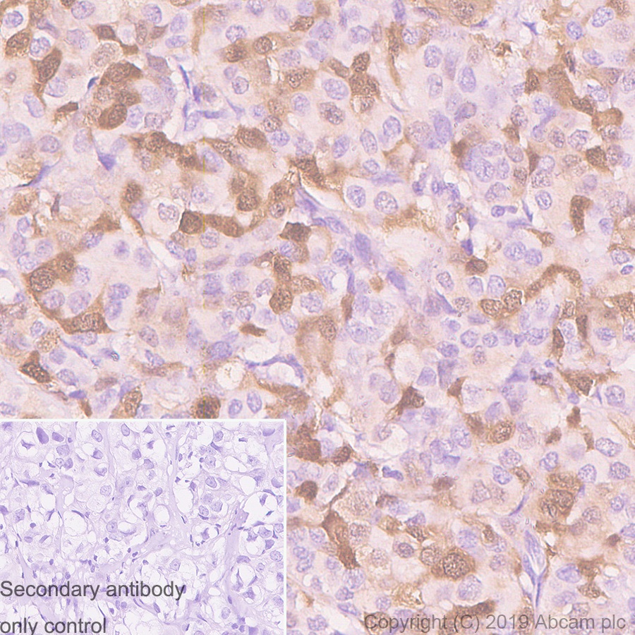 Immunohistochemistry (Formalin/PFA-fixed paraffin-embedded sections) - Anti-CDK1 antibody [YE324] - BSA and Azide free (AB247227), expandable thumbnail